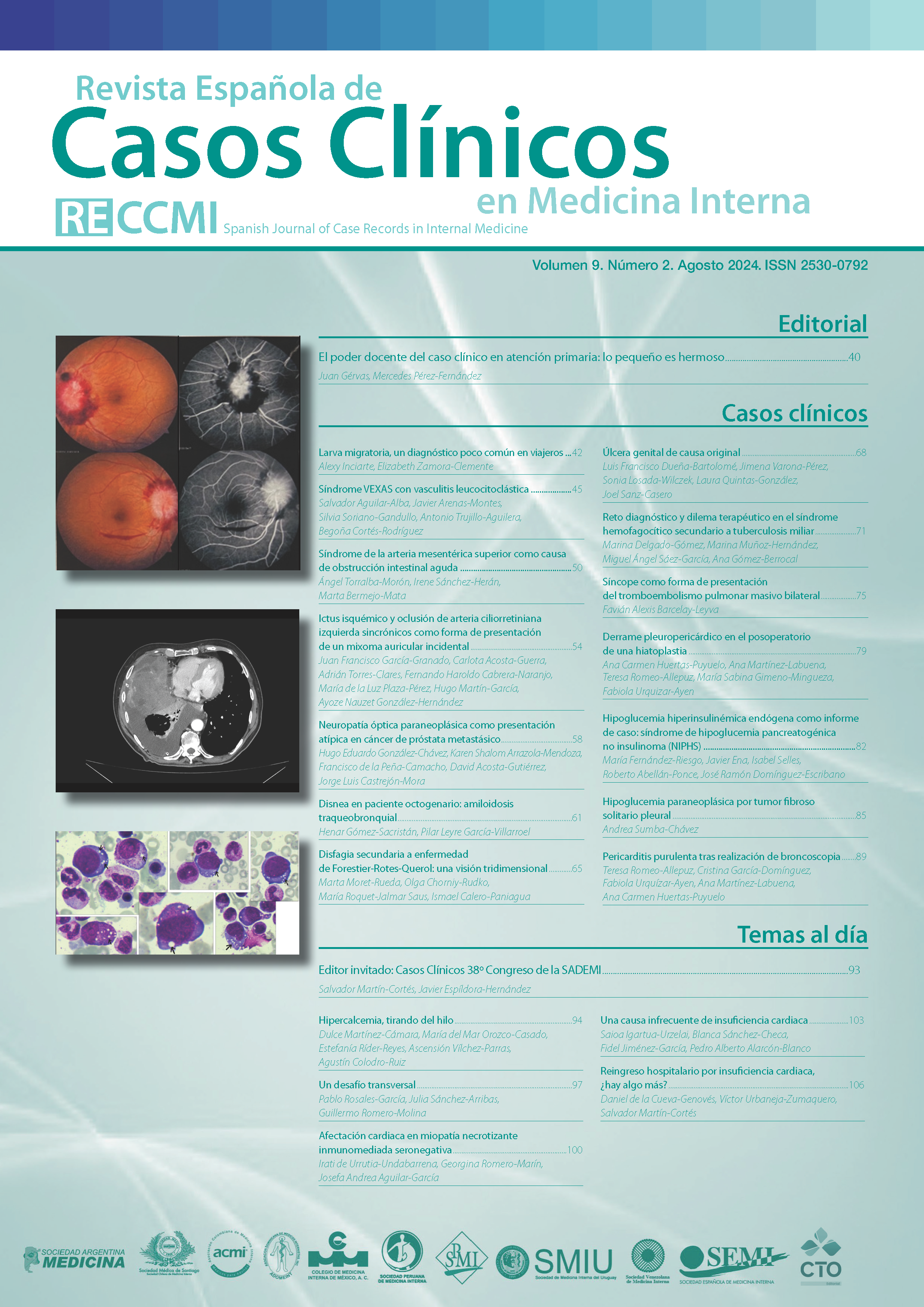 					Ver Vol. 9 Núm. 2 (2024): Revista Española de Casos Clínicos en Medicina Interna
				